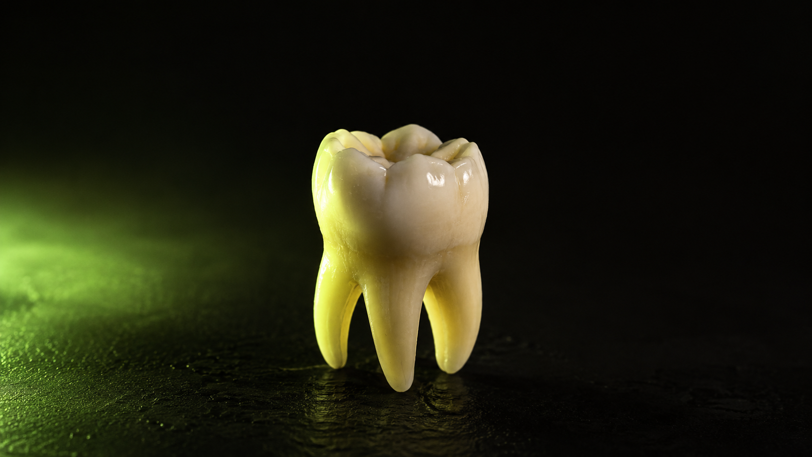 Root Canal